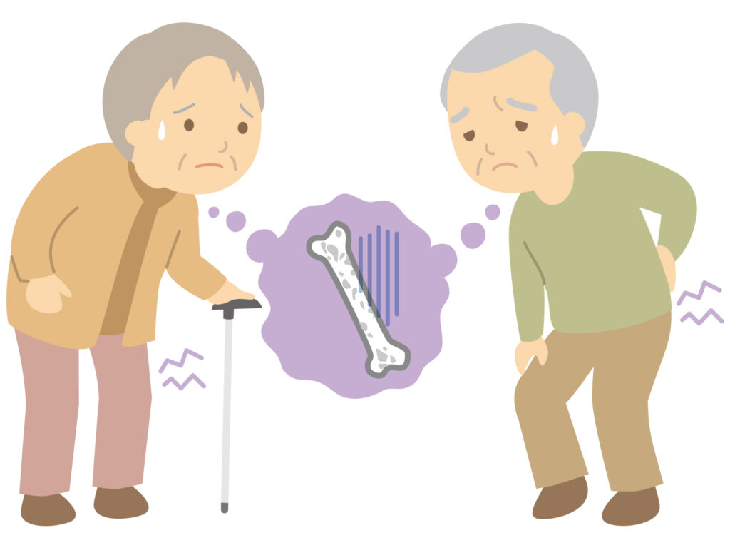 腰のお悩み⑦骨密度の低下による骨粗鬆症によって起きやすくなる脊椎圧迫骨折について説明します