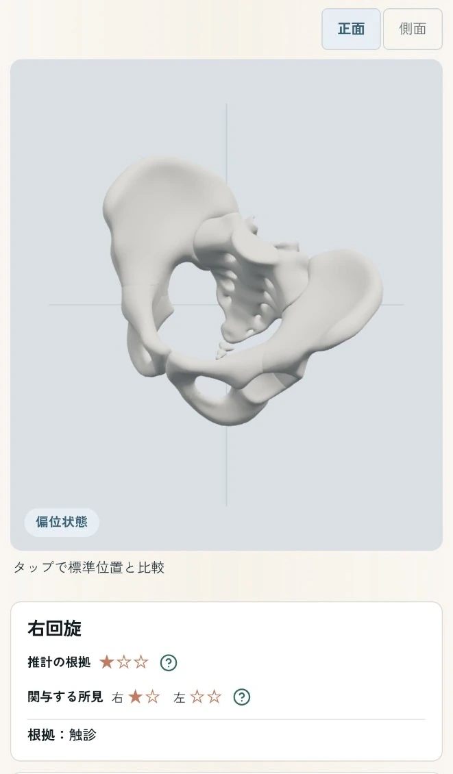 骨盤推計を反映した3D骨盤