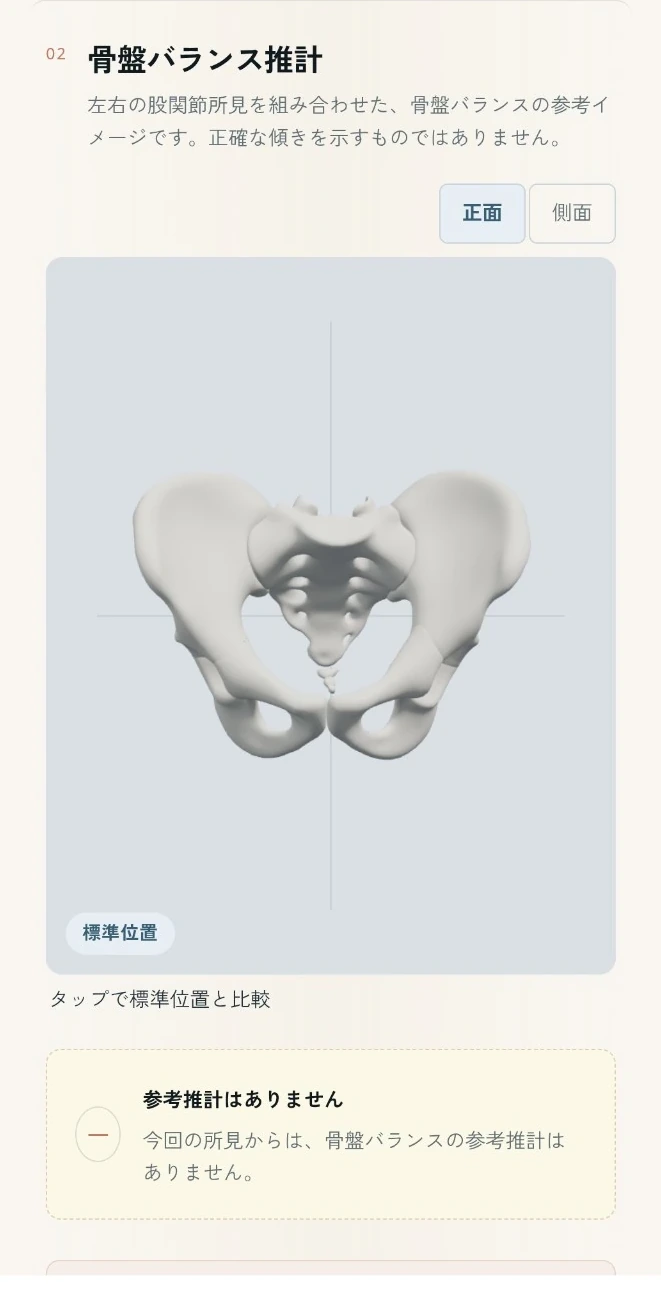 標準位置の3D骨盤
